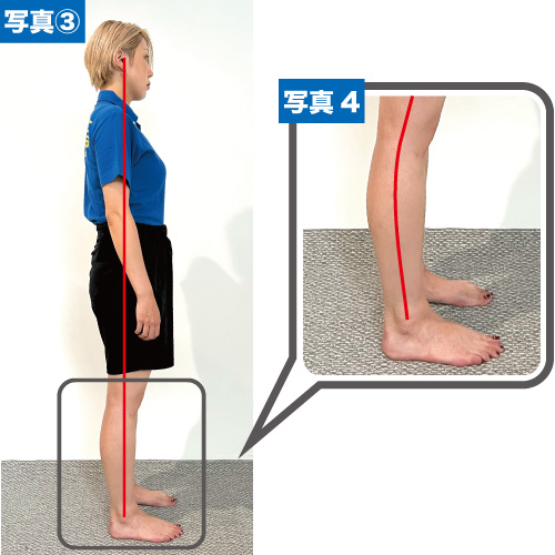 インソールとは？その②