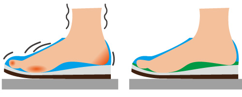 インソールとは？その①