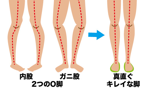 インソールとは？その④